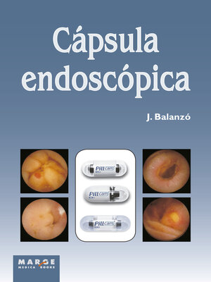 cover image of Cápsula endoscópica